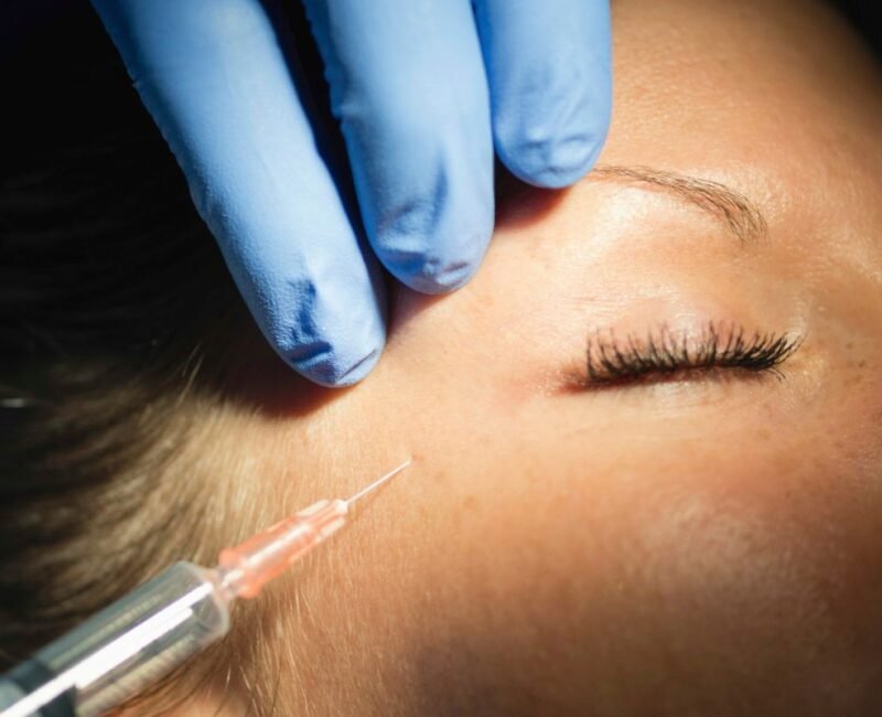 Ενέσεις Βοτουλινικής Τοξίνης (BOTOX)