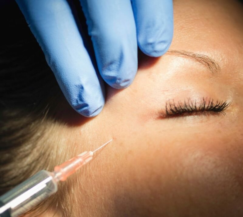 Ενέσεις Βοτουλινικής Τοξίνης (BOTOX)