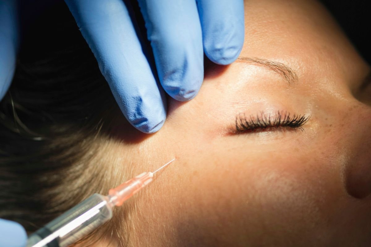 Ενέσεις Βοτουλινικής Τοξίνης (BOTOX)