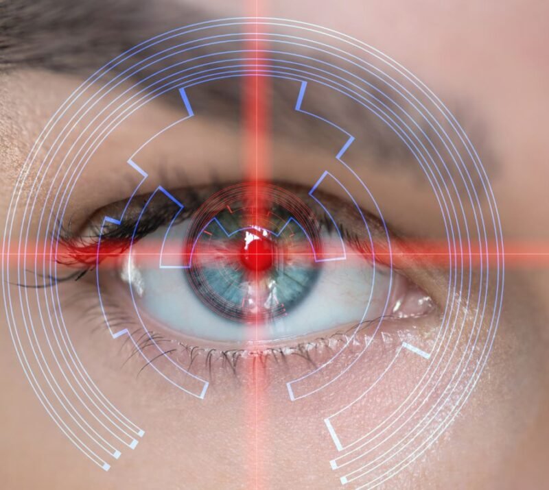 Laser Μυωπίας & Αστιγματισμού – Διόρθωση Όρασης