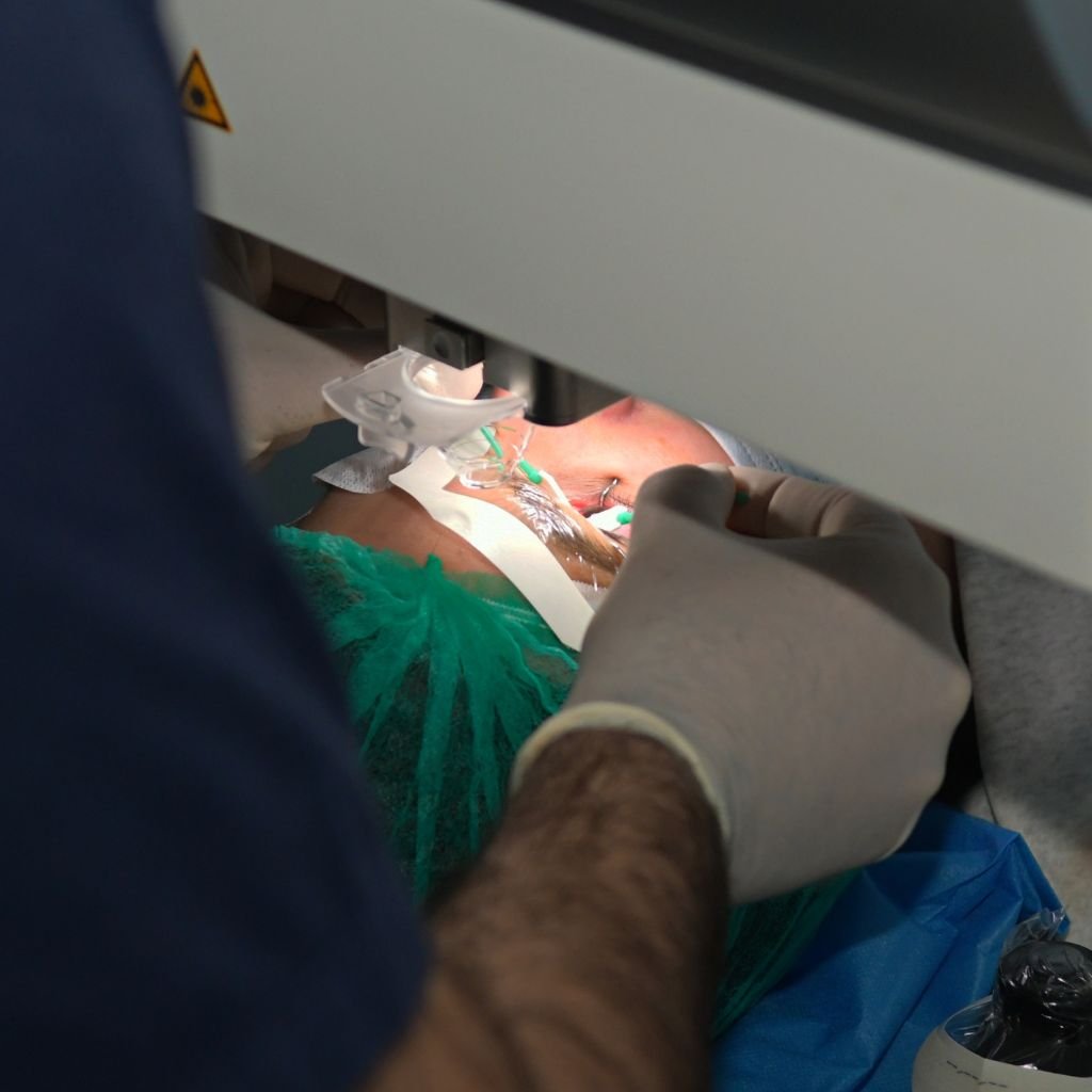 Κοντινό πλάνο από επέμβαση LASIK για τη διόρθωση όρασης
