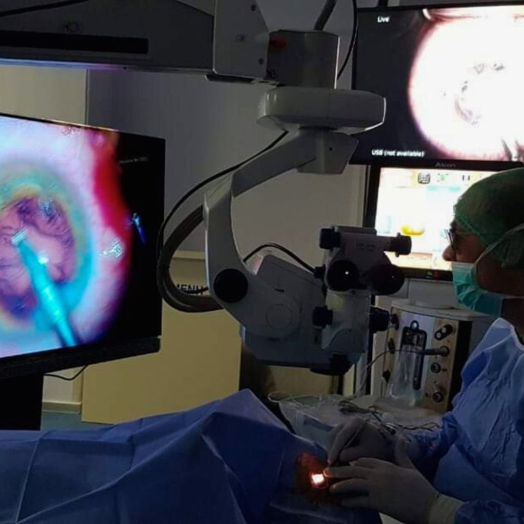 Δημήτριος Μαραγκός Χειρουργός οφθαλμίατρος εκτελεί επέμβαση καταρράκτη με 3D απεικόνιση (phacoemulsification) σε εξειδικευμένη αίθουσα χειρουργείου.